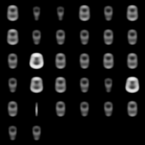 Direct reconstruction